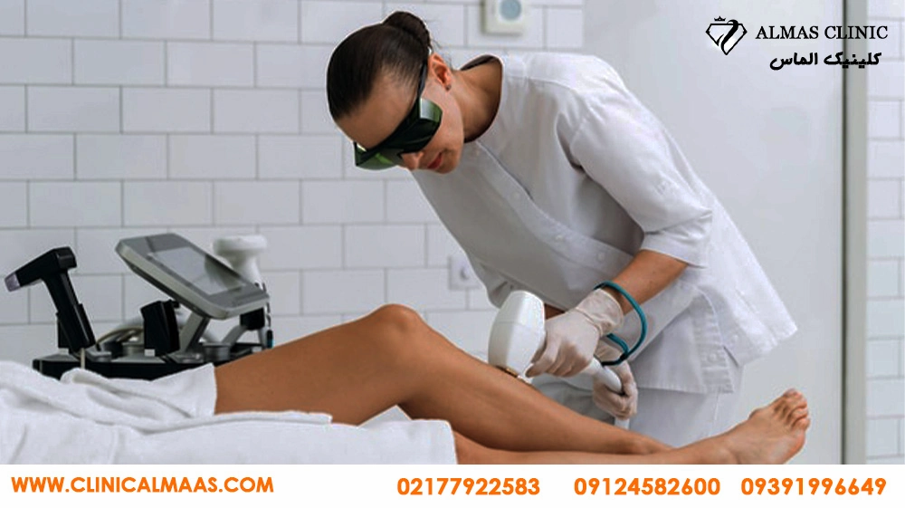 لیزر موهای زائد با دستگاه لیزر کندلا در تهرانپارس