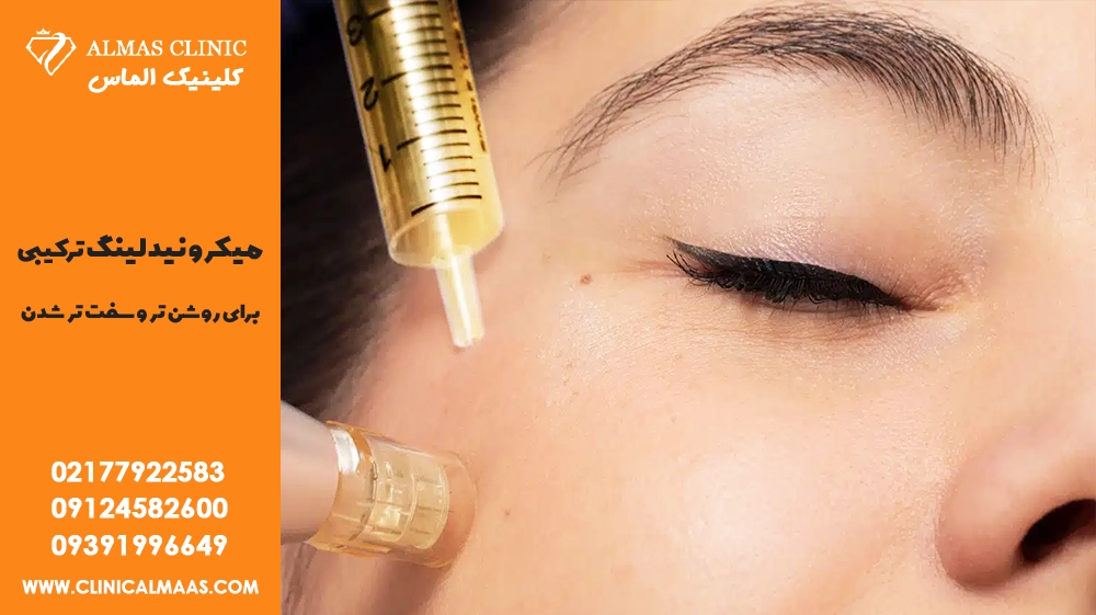 میکرونیدلینگ ترکیبی