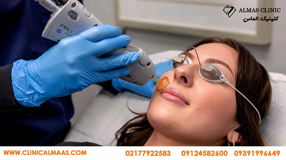 دستگاه کندلا 2024 در بهترین مرکز زیبایی نارمک تهران