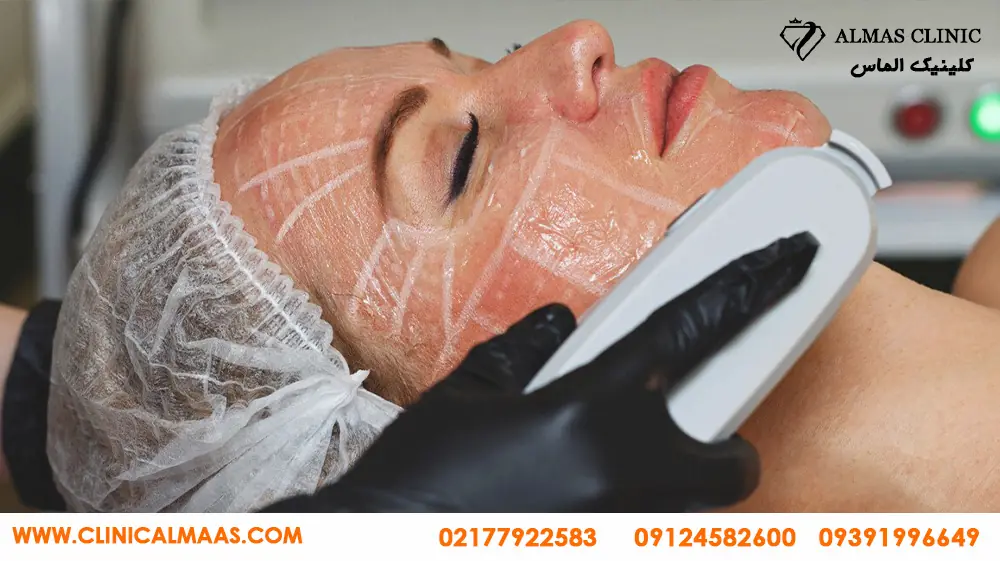 بهترین مرکز هایفوتراپی در تهران 