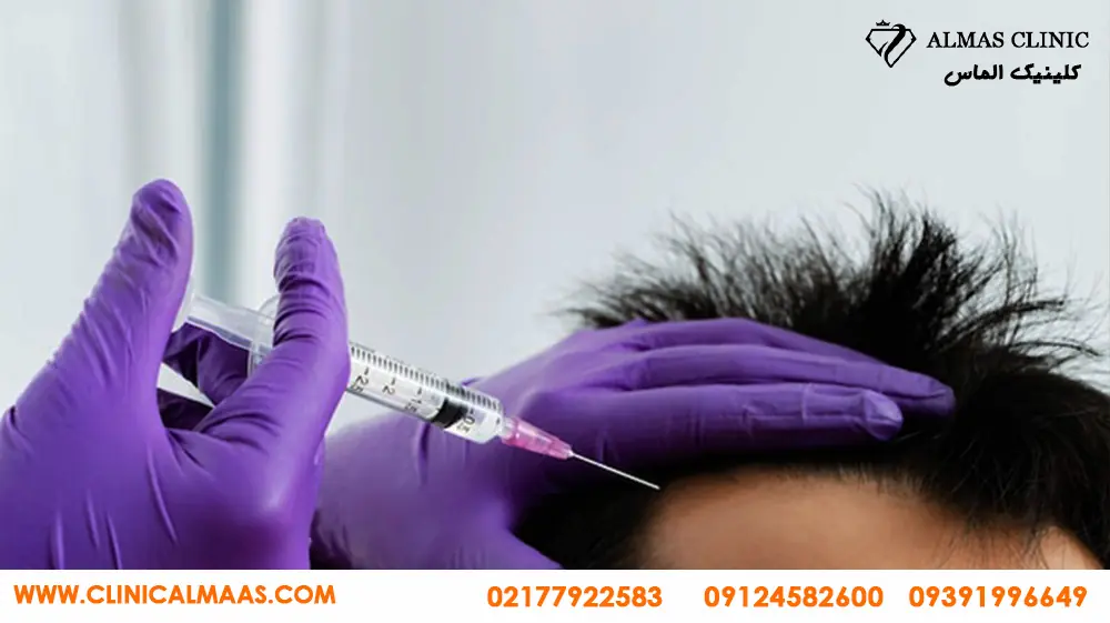 بهترین مرکز مزوتراپی مو در تهران