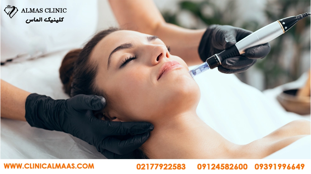  مزایای میکرونیدلینگ