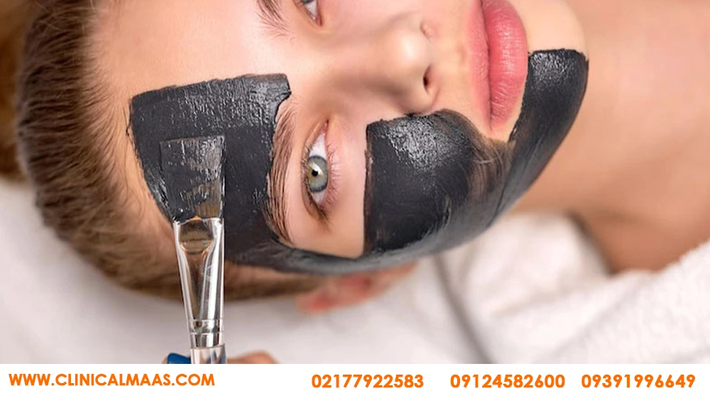 کربن تراپی 