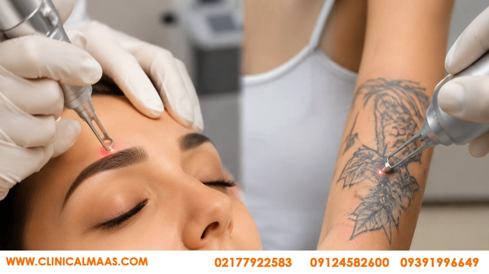 بهترین مرکز ریموو تتو در نارمک و هفت حوض؛ قبل از انتخاب کلینیک به چه نکاتی دقت کنیم؟