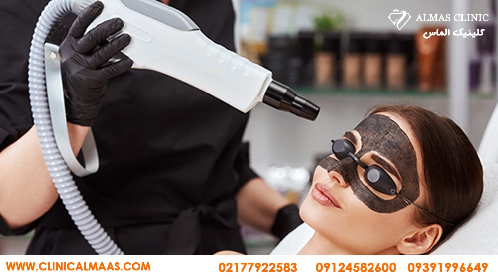 کربن تراپی