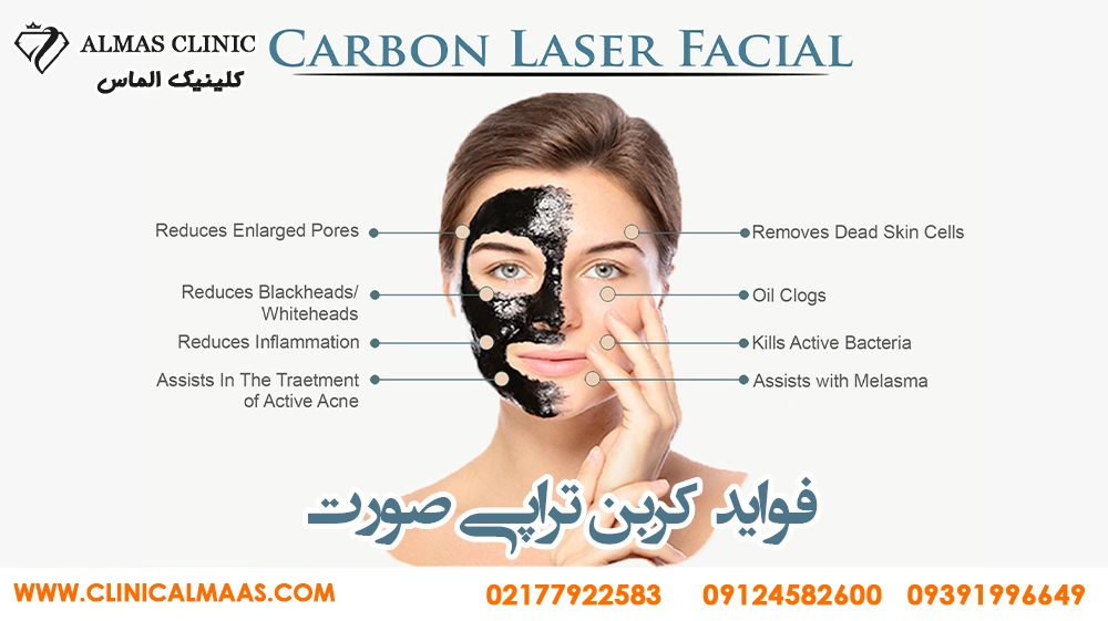 کربن تراپی صورت