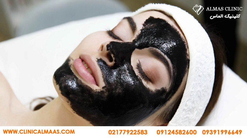 کربن تراپی برای منافذ باز پوست؛ آیا واقعاً منافذ را کوچک می&zwnj;کند؟