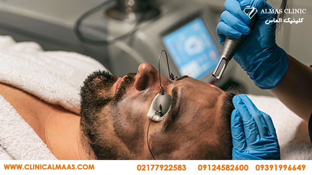 کربن تراپی 
