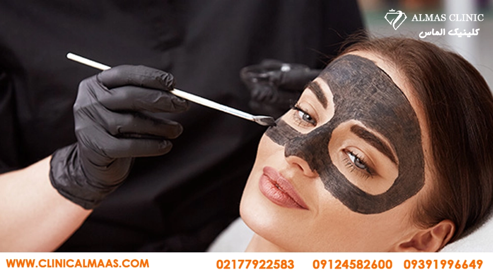 کربن تراپی 