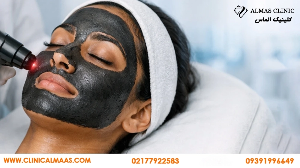 کربن تراپی برای جوش و پوست چرب؛ چند جلسه لازم است و برای چه کسانی مناسب نیست؟