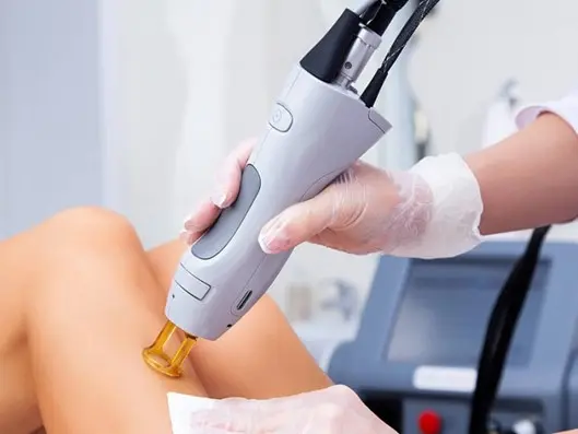 لیزر کندلا در پاسداران