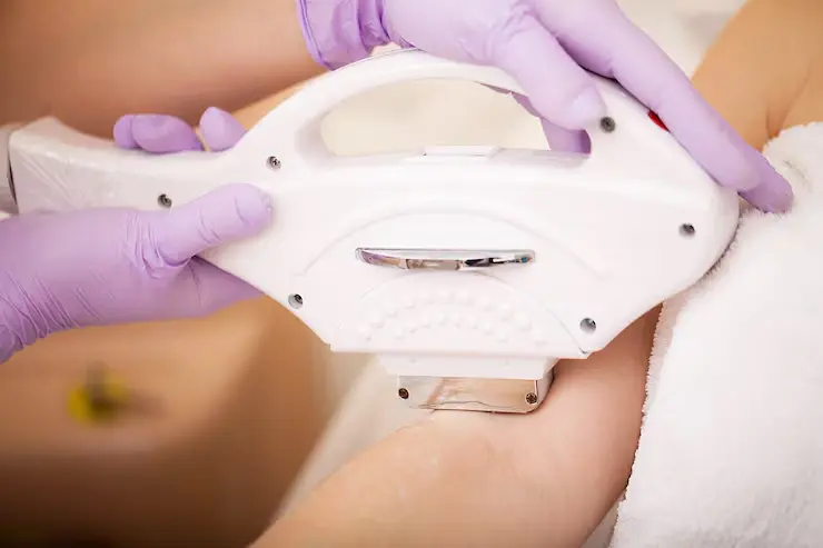 بهترین مرکز لیزر کندلا در هفت حوض