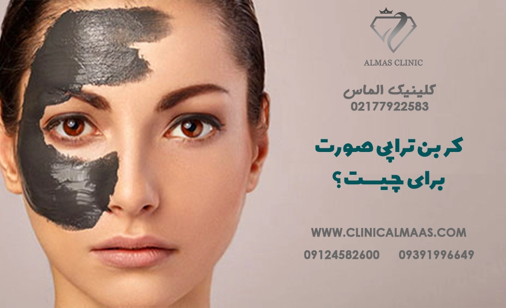 کربن تراپی صورت برای چیست؟ فواید، کاربردها، عوارض و تفاوت آن با فیشیال