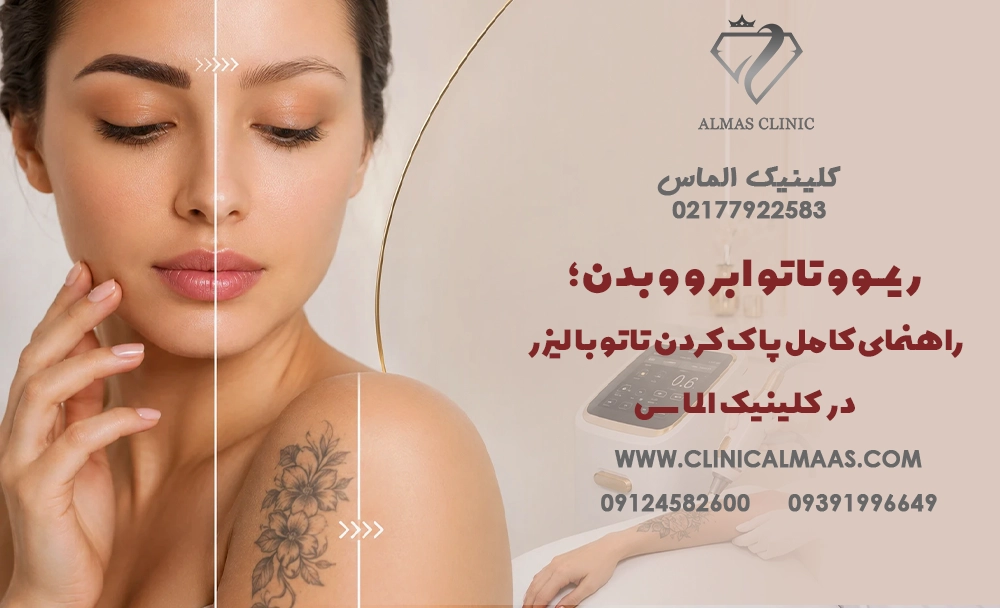 ریمــوو تاتو ابرو و بدن؛ راهنمای کامل پاک کردن تاتو با لیزر در کلینیک الماس