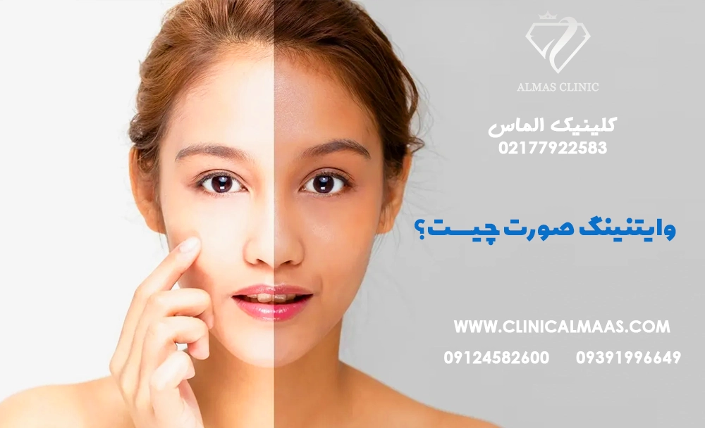 وایتنینگ صورت چیست؟ بررسی کامل فواید، عوارض، قیمت و تفاوت آن