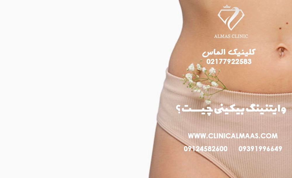 وایتنینگ بیکینی چیست؟ راهنمای کامل روشن سازی و رفع تیرگی ناحیه بیکینی