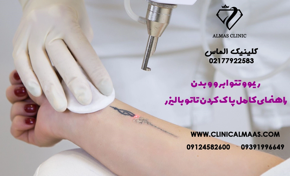 ریموو تتو ابرو و بدن؛ راهنمای کامل پاک کردن تاتو با لیزر