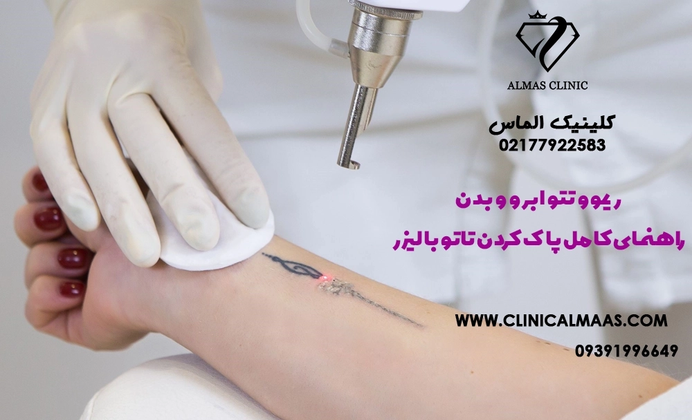 ریموو تتو ابرو و بدن؛ راهنمای کامل پاک کردن تاتو با لیزر