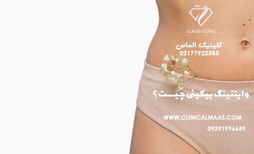 وایتنینگ بیکینی چیست؟ راهنمای کامل روشن سازی و رفع تیرگی ناحیه بیکینی