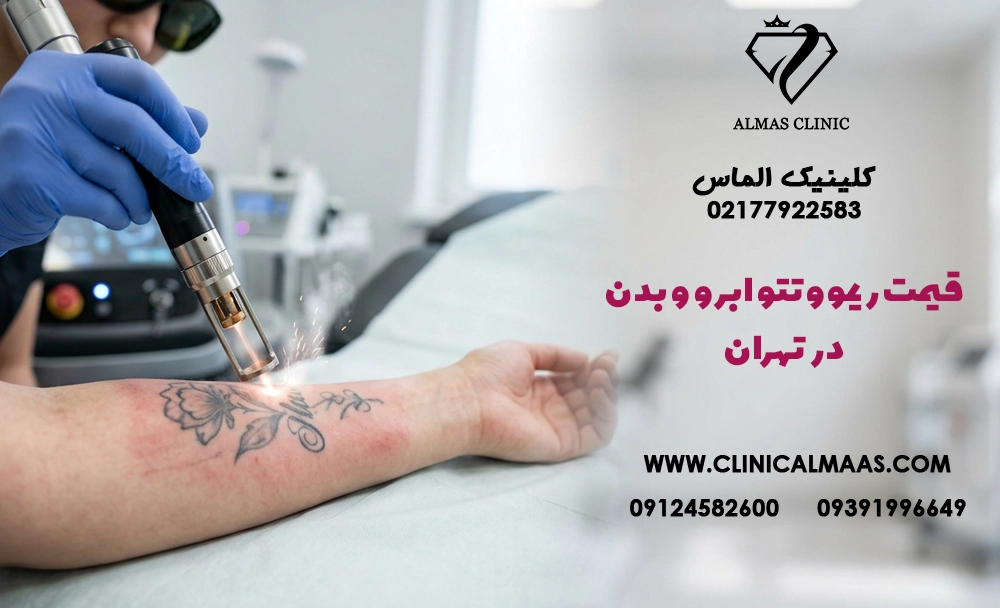 قیمت ریموو تتو ابرو و بدن در تهران در سال ۱۴۰۵؛ هزینه هر جلسه چقدر است؟