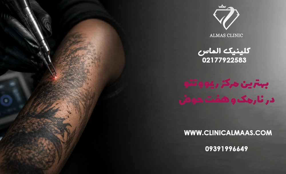 بهترین مرکز ریموو تتو در نارمک و هفت حوض؛ قبل از انتخاب کلینیک به چه نکاتی دقت کنیم؟