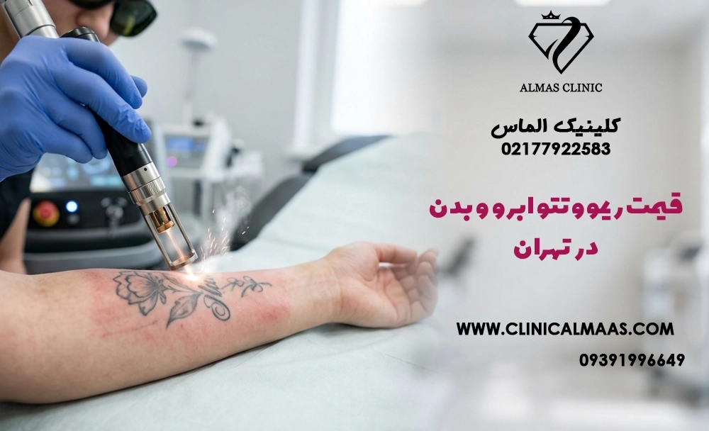 قیمت ریموو تتو ابرو و بدن در تهران در سال ۱۴۰۵؛ هزینه هر جلسه چقدر است؟