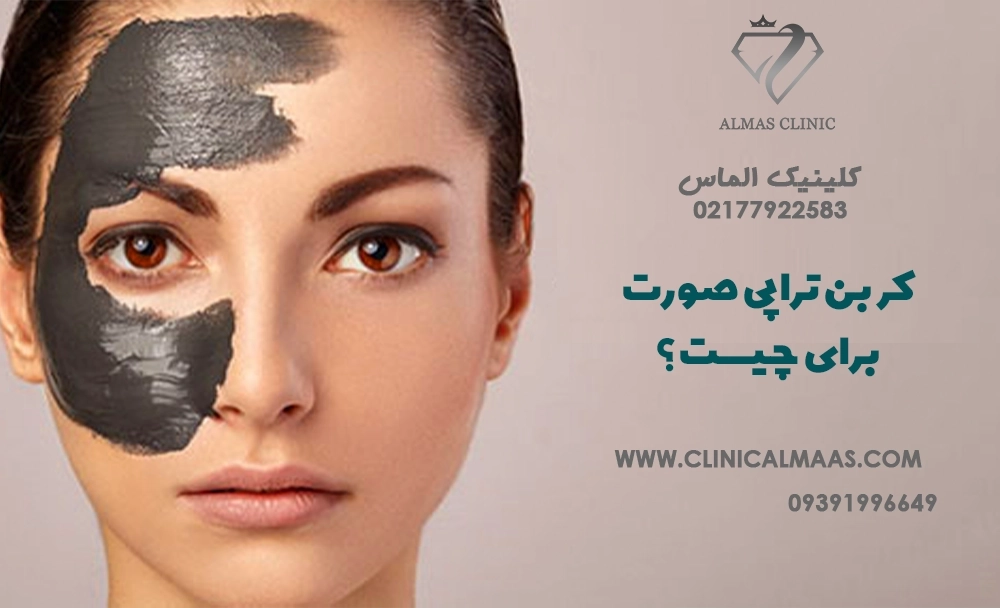 کربن تراپی صورت برای چیست؟ فواید، کاربردها، عوارض و تفاوت آن با فیشیال