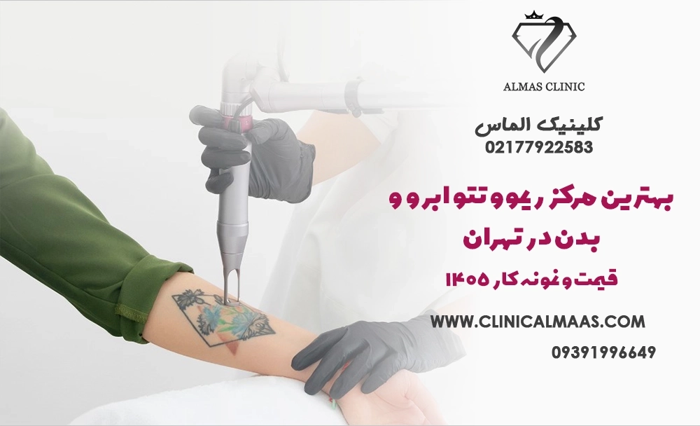 بهترین مرکز ریموو تتو ابرو و بدن در تهران + قیمت و نمونه کار 1405