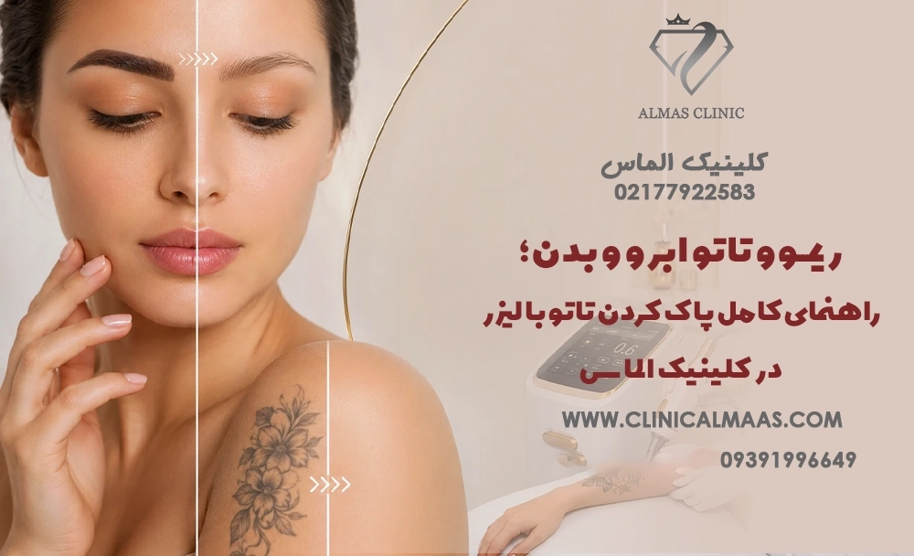 ریمــوو تاتو ابرو و بدن؛ راهنمای کامل پاک کردن تاتو با لیزر در کلینیک الماس