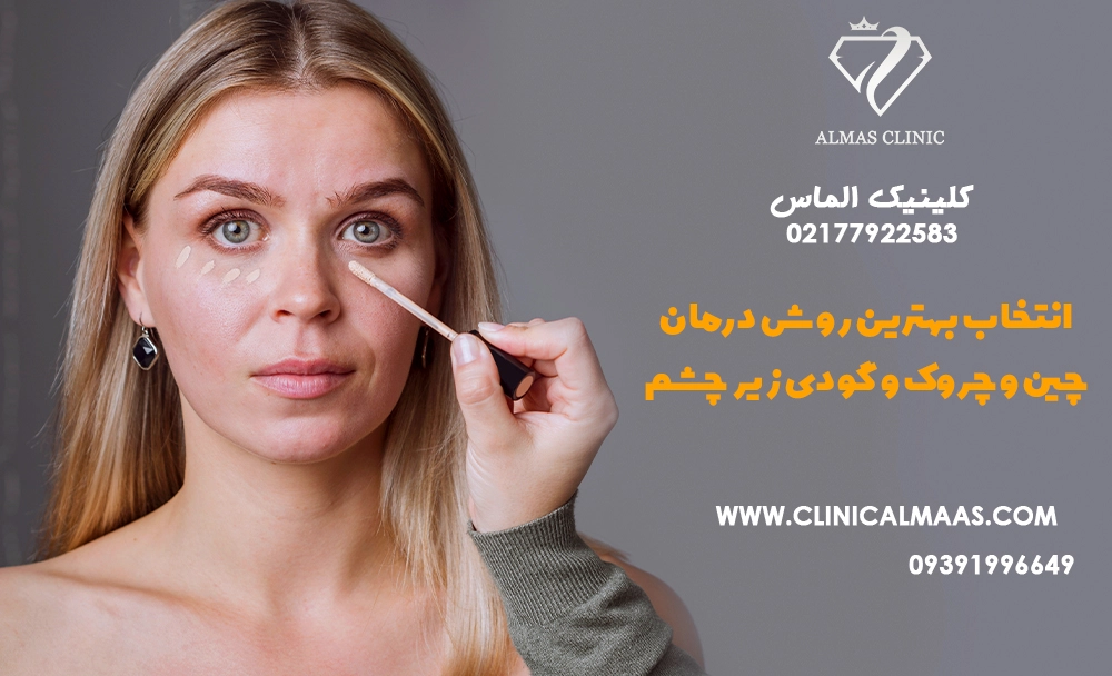 انتخاب بهترین روش برای درمان چین و چروک‌ها، خطوط لبخند و گودی زیر چشم