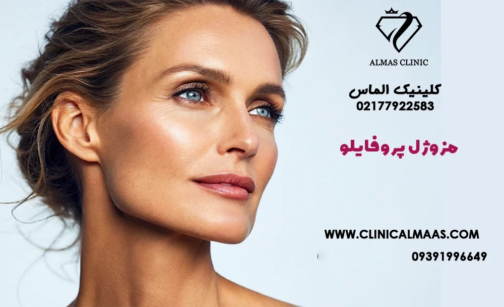 مزوژل پروفایلو