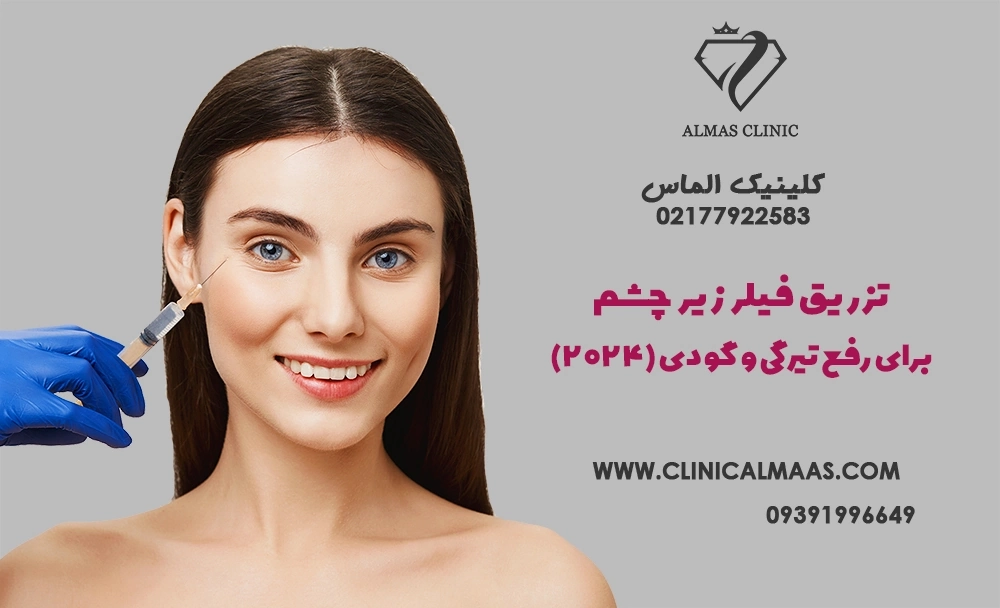 تزریق فیلر زیر چشم برای رفع تیرگی و گودی (2024)