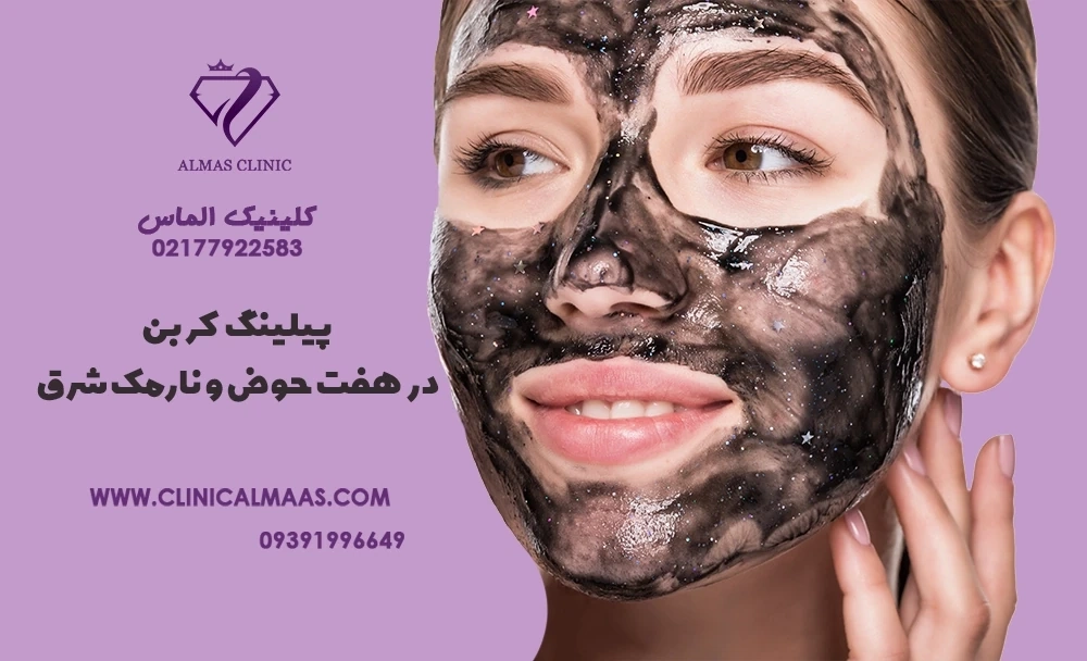 پیلینگ کربن در هفت حوض نارمک شرق