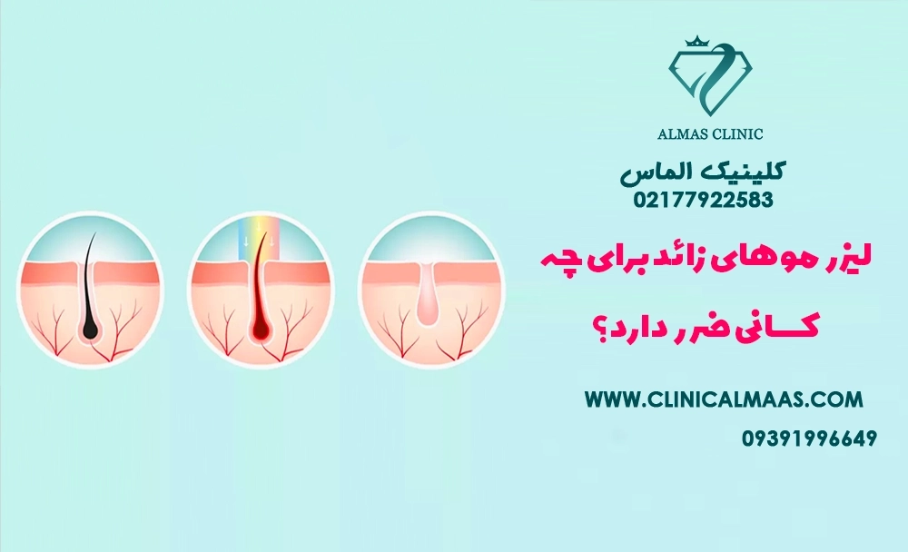 لیزر موهای زائد برای چه کسانی ضرر دارد؟