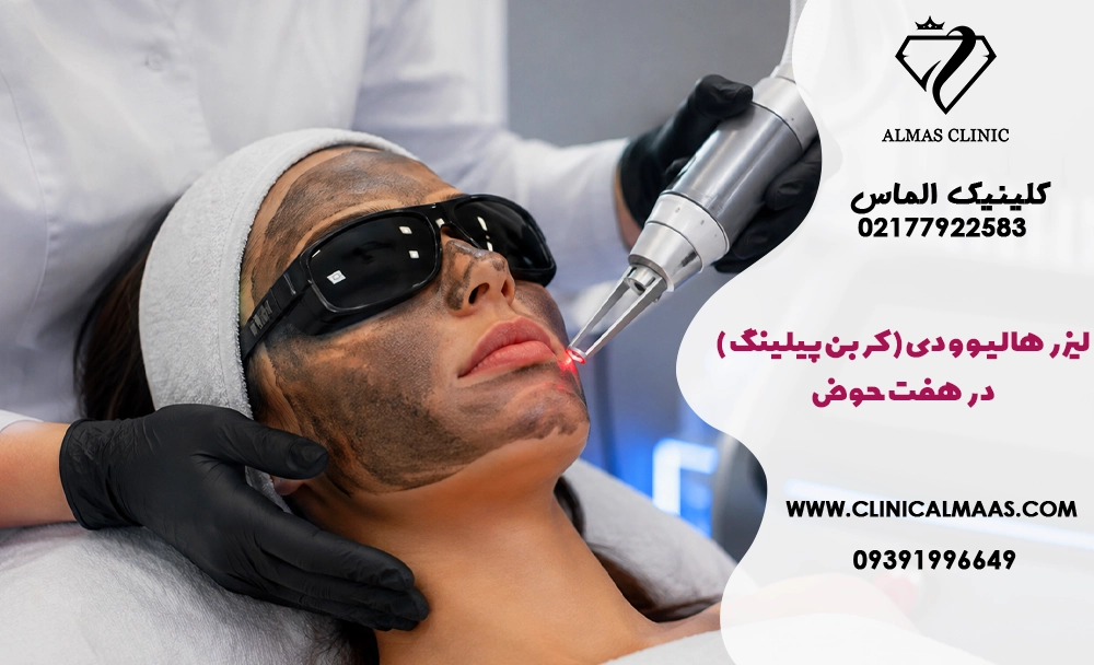 لیزر هالیوودی (کربن پیلینگ) در هفت حوض