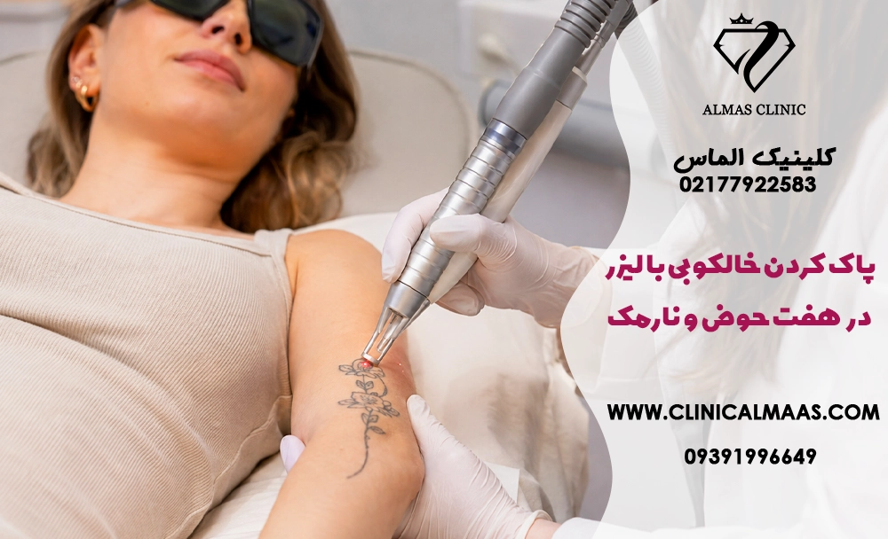 پاک کردن خالکوبی با لیزر در هفت حوض و نارمک؛ تعداد جلسات، هزینه و مراقبت‌ها