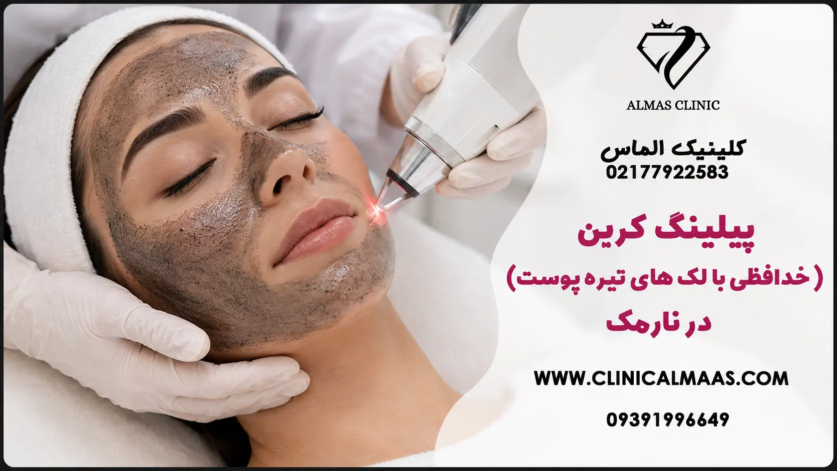 پیلینگ کربن (خداحافظی با لک‌های تیره پوست) در نارمک
