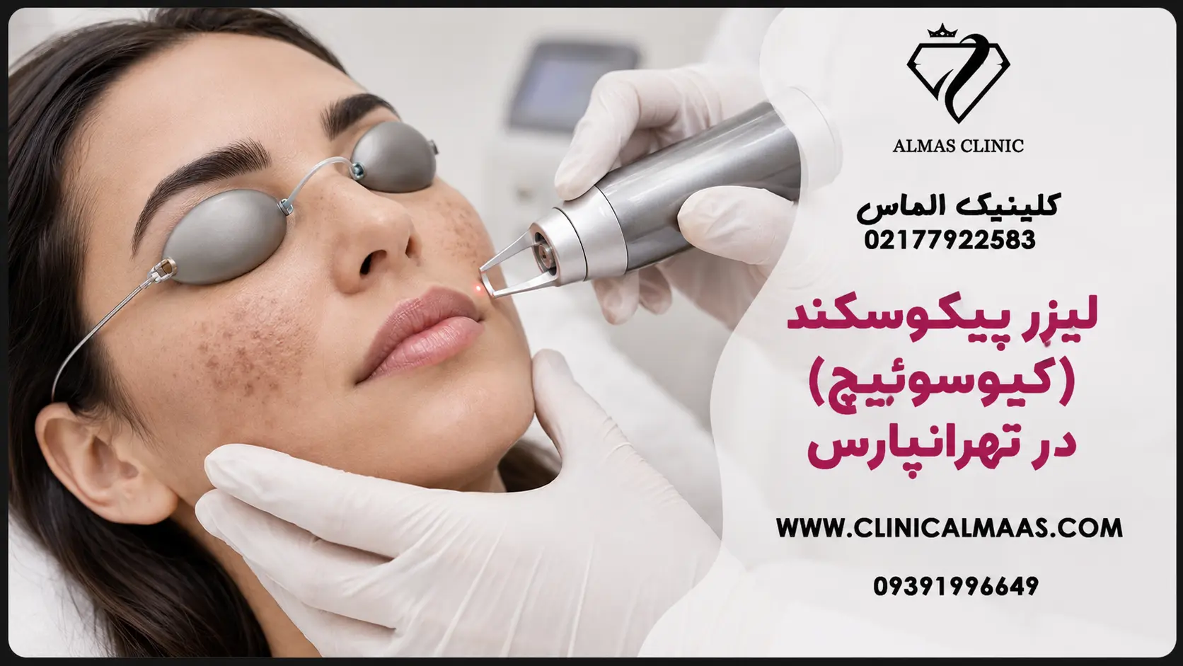 لیزر پیکوسکند (کیوسوئیچ) در تهرانپارس؛ درمان لک، کک و مک و ریموو تاتو