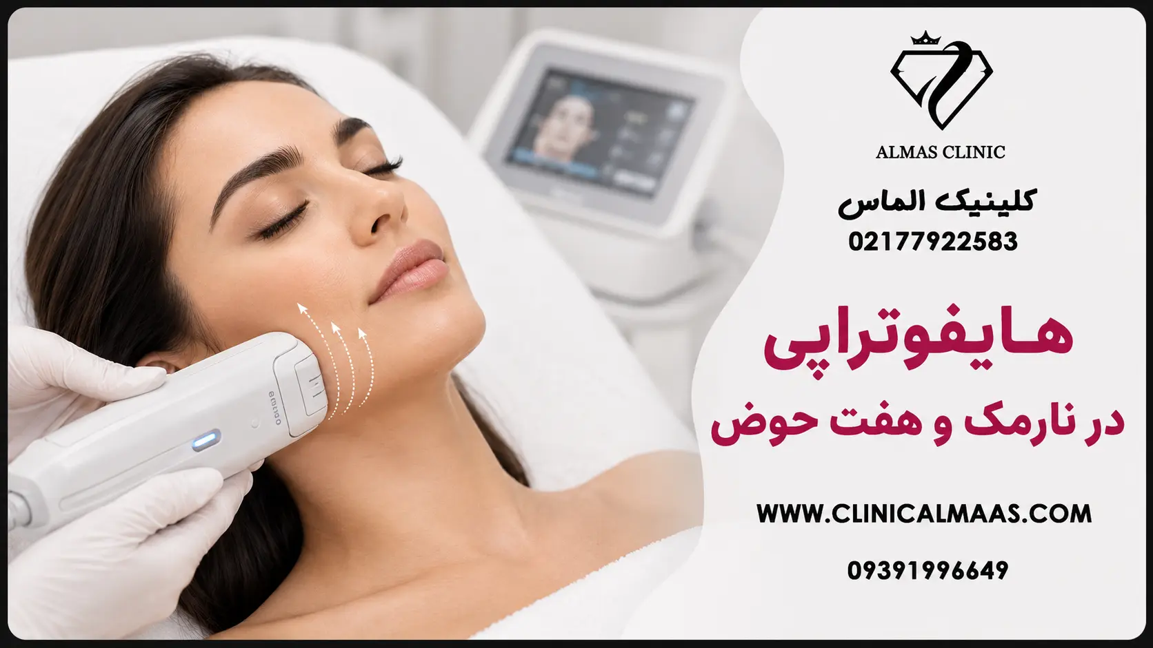 هایفوتراپی صورت و گردن؛ لیفت و جوانسازی بدون جراحی، ماندگاری و هزینه