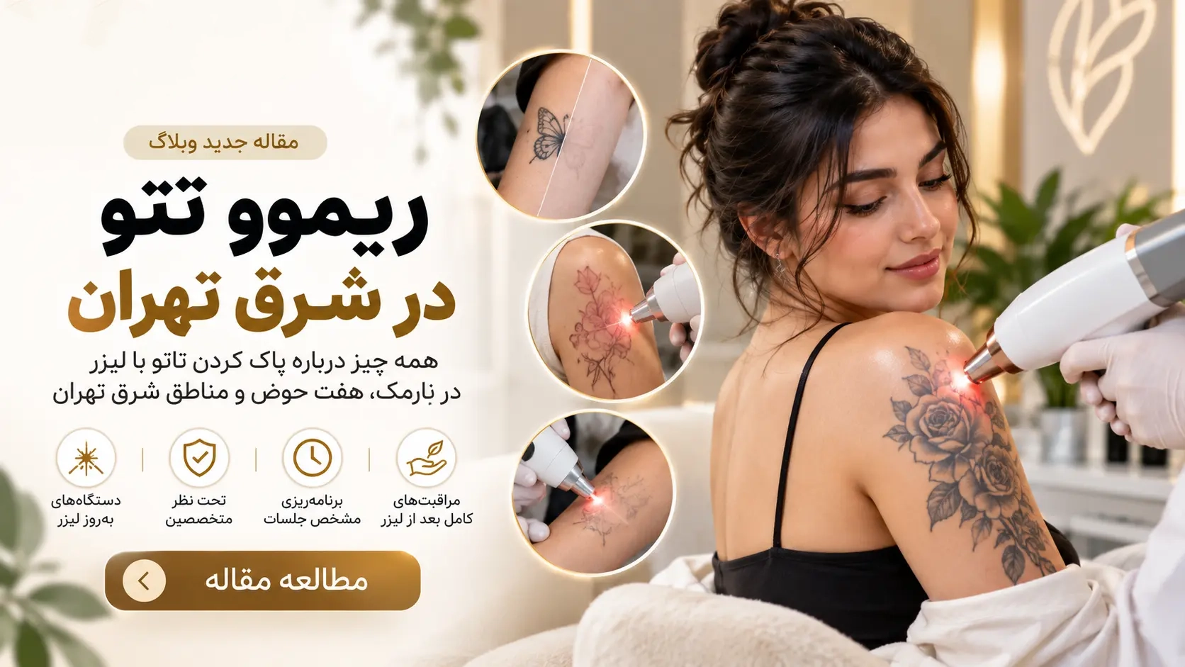 ریموو تتو در شرق تهران؛ راهنمای پاک کردن تاتو با لیزر