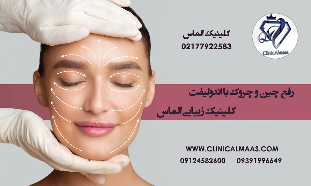 رفع چین و چروک با اندولیفت در بهترین کلینیک هفت حوض | کلینیک زیبایی الماس