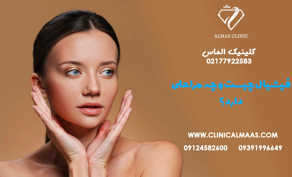 فیشیال چیست و چه مراحلی دارد؟