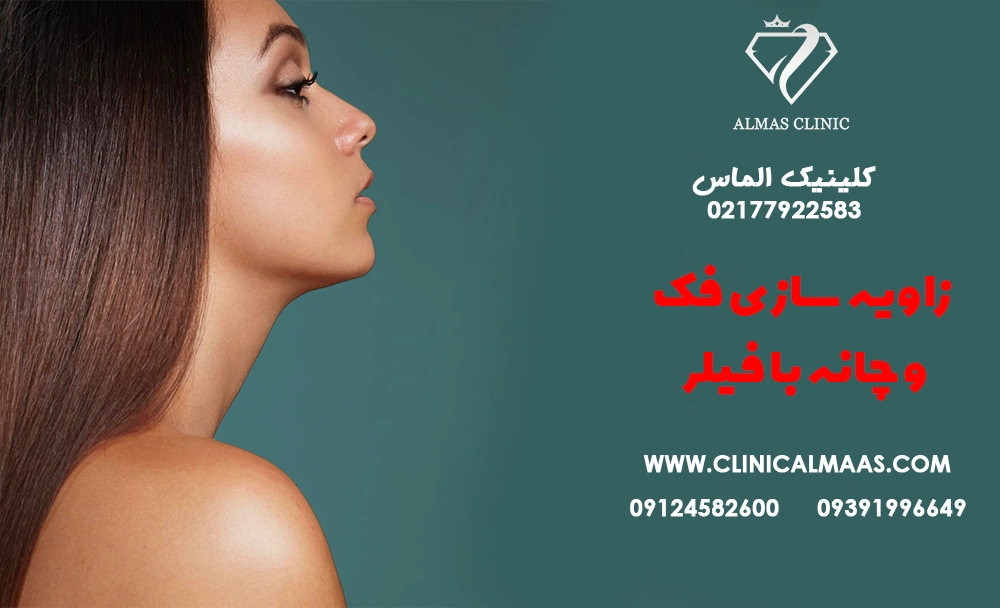 زاویه‌سازی فک و چانه با فیلر یا نخ؟ ماندگاری و ریسک‌ها