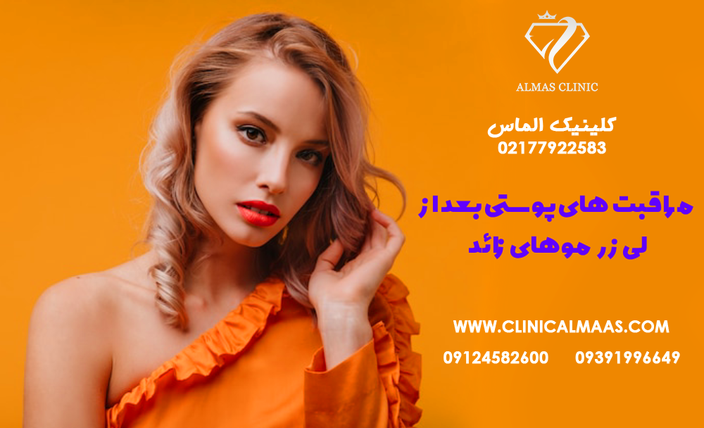 مراقبت‌های پوستی بعد از لیزر موهای زائد