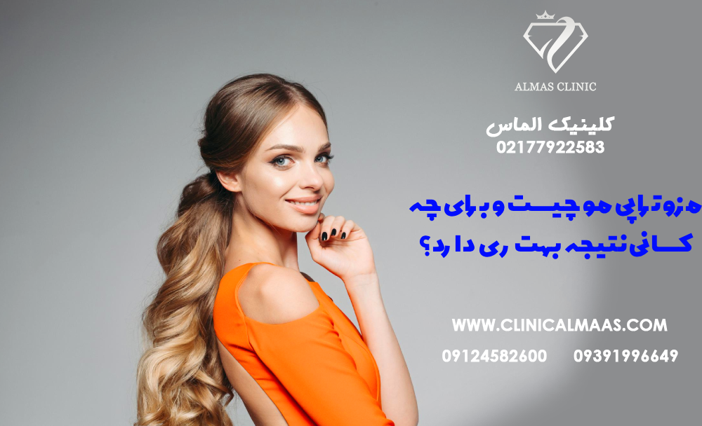 مزوتراپی مو چیست و برای چه کسانی نتیجه بهتری دارد؟