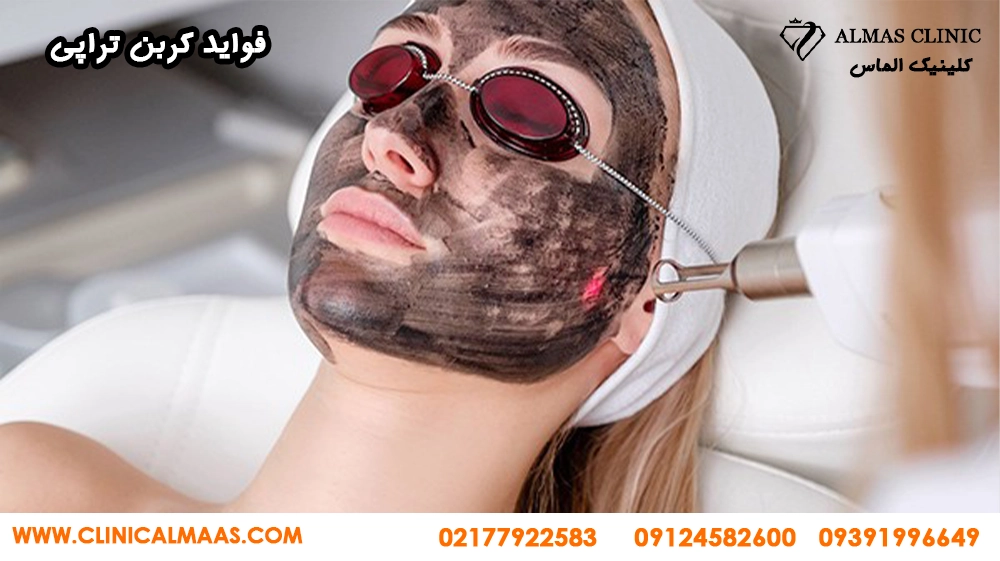 کربن تراپی