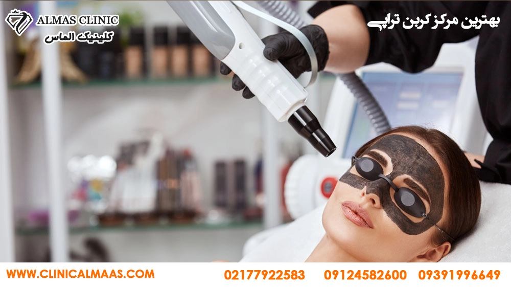 کربن تراپی صورت