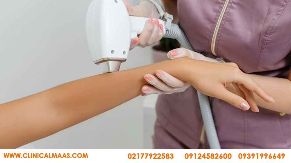 لیزر موهای زائد با دستگاه کندلا بهتر است یا دایود؟ کدام برای پوست سبزه مناسب&zwnj;تر است؟