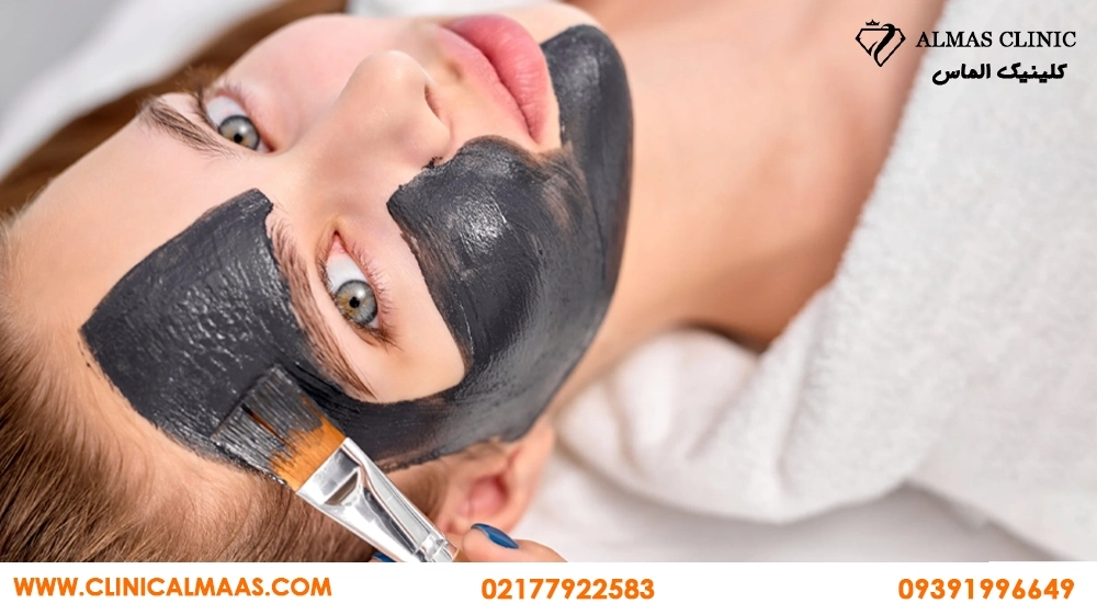 کربن تراپی برای جوش و پوست چرب؛ چند جلسه لازم است و برای چه کسانی مناسب نیست؟