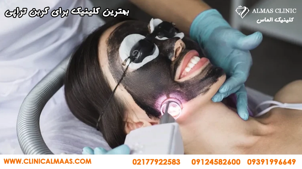 کربن تراپی